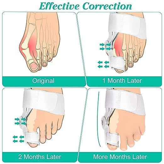 Bunion Brace Corrector